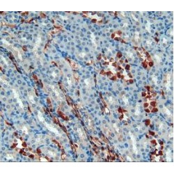 S100 Calcium Binding Protein A6 (S100A6) Antibody
