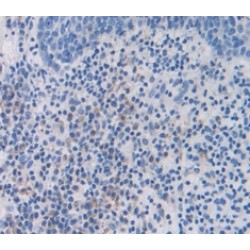 S100 Calcium Binding Protein A7 (S100A7) Antibody