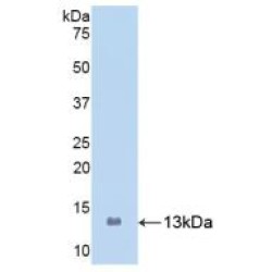 Protein S100-A8 / CAGA (S100A8) Antibody