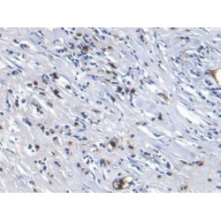Protein S100-A8 / CAGA (S100A8) Antibody