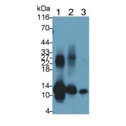 Western blot analysis of (1) Human Leukocyte lysate, (2) Human Lymphocyte lysate, (3) Human Saliva, using Mouse Anti-Human S100A8 Antibody (0.5 µg/ml) and HRP-conjugated Goat Anti-Mouse antibody (<a href="https://www.abbexa.com/index.php?route=product/search&amp;search=abx400001" target="_blank">abx400001</a>, 0.2 µg/ml).