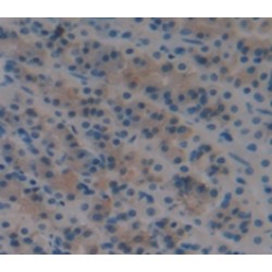 Protein S100-A8 / CAGA (S100A8) Antibody