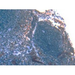 Protein S100-A8 / CAGA (S100A8) Antibody