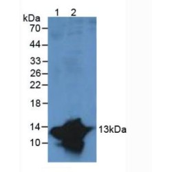 Protein S100-A9 / CAGB (S100A9) Antibody