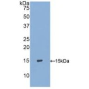 Western blot analysis of recombinant Human S100A9.