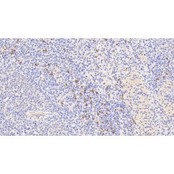 Protein S100-A9 / CAGB (S100A9) Antibody