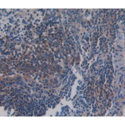 Protein S100-A9 / CAGB (S100A9) Antibody