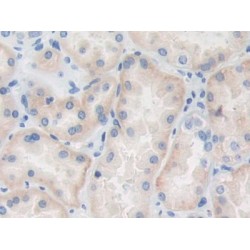 TNF Receptor Associated Factor 4 (TRAF4) Antibody