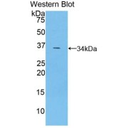 Western blot analysis of the recombinant protein.