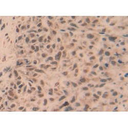 TNF Receptor Associated Factor 5 (TRAF5) Antibody
