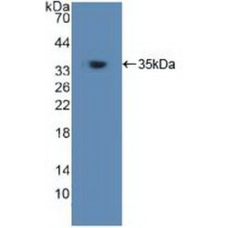 TNF Receptor Associated Factor 6 (TRAF6) Antibody