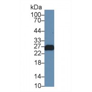 Western blot analysis of Mouse Skeletal muscle lysate, using Human TNNI1 Antibody (1 µg/ml) and HRP-conjugated Goat Anti-Rabbit antibody (<a href="https://www.abbexa.com/index.php?route=product/search&amp;search=abx400043" target="_blank">abx400043</a>, 0.2 µg/ml).