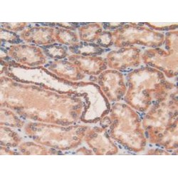 Acyl Carrier Protein, Mitochondrial (ACP) Antibody