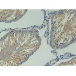 B-Cell Activation Factor Receptor / BAFFR (TNFRSF13C) Antibody