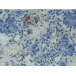 B-Cell Activation Factor Receptor / BAFFR (TNFRSF13C) Antibody
