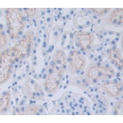 Cyclic ADP-Ribose Hydrolase 2 (BST1) Antibody