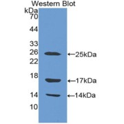 Western blot analysis of the recombinant protein.