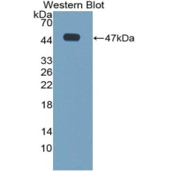 Cathelicidin Antimicrobial Peptide (CAMP) Antibody