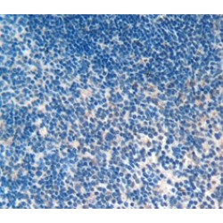 Cathelicidin Antimicrobial Peptide (CAMP) Antibody