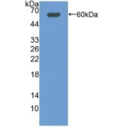 Deiodinase, Iodothyronine, Type II (DIO2) Antibody