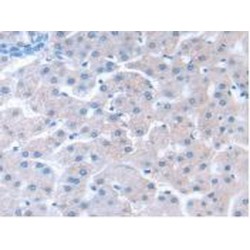 G Protein Beta Subunit Like Protein (GbL) Antibody