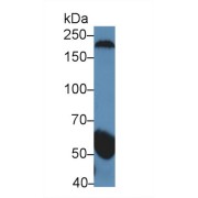 Western blot analysis of Human Serum, using Human gSAP Antibody (5 µg/ml) and HRP-conjugated Goat Anti-Rabbit antibody (<a href="https://www.abbexa.com/index.php?route=product/search&amp;search=abx400043" target="_blank">abx400043</a>, 0.2 µg/ml).