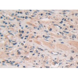Gamma-Secretase Activating Protein (gSAP) Antibody