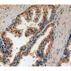 Gamma-Secretase Activating Protein (gSAP) Antibody