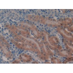 Glutathione S Transferase Alpha 1 (GSTa1) Antibody