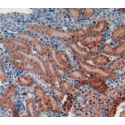 Glutathione S Transferase Alpha 1 (GSTa1) Antibody