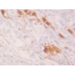 Glutathione S Transferase Alpha 2 (GSTa2) Antibody