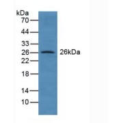 Western blot analysis of Human Lung Tissue.