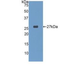 Glutathione S Transferase Alpha 4 (GSTa4) Antibody