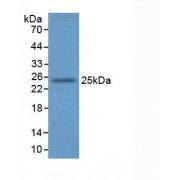 Western blot analysis of Mouse Lung Tissue.