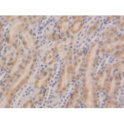 Glutathione S Transferase Alpha 5 (GSTa5) Antibody