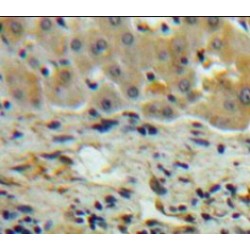 Glutathione S Transferase Alpha 5 (GSTa5) Antibody