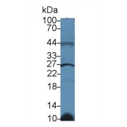 Western blot analysis of Human Raji cell lysate, using Rat GSTk1 Antibody (2 µg/ml) and HRP-conjugated Goat Anti-Rabbit antibody (<a href="https://www.abbexa.com/index.php?route=product/search&amp;search=abx400043" target="_blank">abx400043</a>, 0.2 µg/ml).