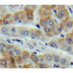 Glutathione S Transferase Kappa 1 (GSTk1) Antibody
