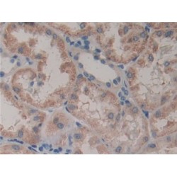 Glutathione S Transferase Theta 2 (GSTt2) Antibody