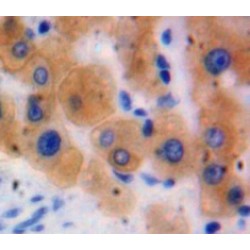 Glutathione S Transferase Theta 2 (GSTt2) Antibody