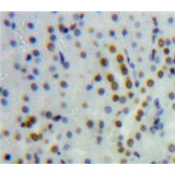 Hepatocyte Nuclear Factor 4 Alpha (HNF4a) Antibody