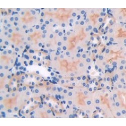 Intercellular Adhesion Molecule 1 (ICAM1) Antibody