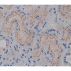 Intercellular Adhesion Molecule 1 (ICAM1) Antibody