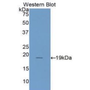 abx103621