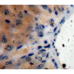 Interleukin 1 Receptor Antagonist (IL1RN) Antibody