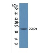 Western blot analysis of recombinant Rabbit IL1RA.