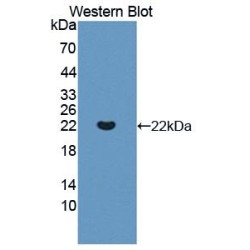 Interleukin 13 Receptor Alpha 1 (IL13Ra1) Antibody