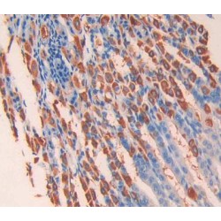 Interleukin 13 Receptor Alpha 1 (IL13Ra1) Antibody