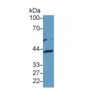 Western blot analysis of Human HepG2 cell lysate, using Human IL13Ra2 Antibody (1 µg/ml) and HRP-conjugated Goat Anti-Rabbit antibody (<a href="https://www.abbexa.com/index.php?route=product/search&amp;search=abx400043" target="_blank">abx400043</a>, 0.2 µg/ml).