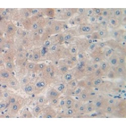 Mercaptopyruvate Sulfurtransferase (MPST) Antibody